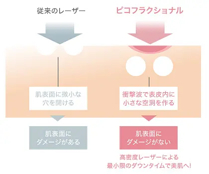 従来のレーザーとピコレーザ−の違い図