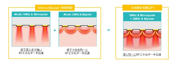 説明図